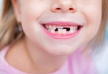Ipofosfatasia lieve e ortodonzia: uno studio sui rischi per l’osso alveolare Ipofosfatasia