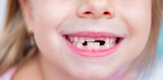Ipofosfatasia lieve e ortodonzia: uno studio sui rischi per l’osso alveolare Ipofosfatasia