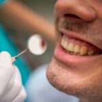Lesioni radicolari, allo studio un nuovo composito bioattivo Lesioni radicolari