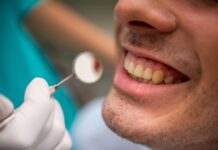 Lesioni radicolari, allo studio un nuovo composito bioattivo Lesioni radicolari
