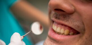 Lesioni radicolari, allo studio un nuovo composito bioattivo Lesioni radicolari