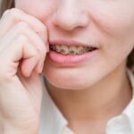 Dolore ortodontico, come trattarlo per migliorare l’esperienza del paziente Dolore ortodontico