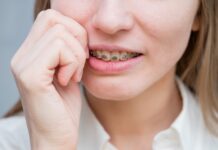 Dolore ortodontico, come trattarlo per migliorare l’esperienza del paziente Dolore ortodontico