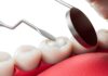I nuovi compositi BPA-free superano il test di resistenza Nuovi compositi BPA-free
