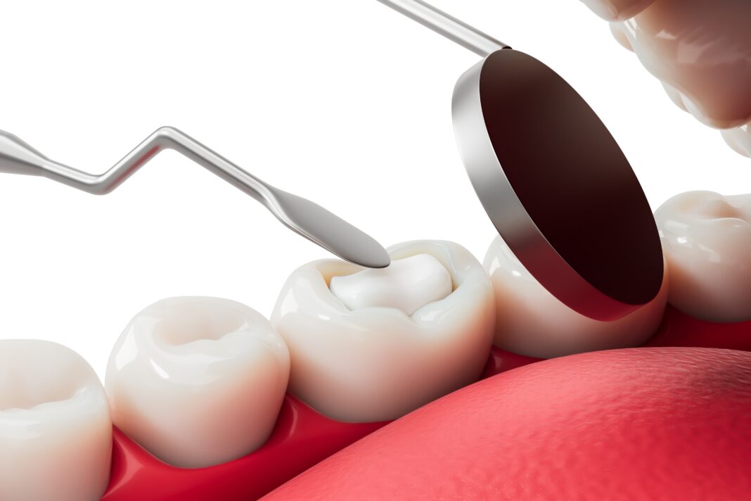 Nuovi compositi BPA-free