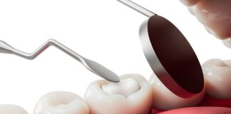 I nuovi compositi BPA-free superano il test di resistenza Nuovi compositi BPA-free