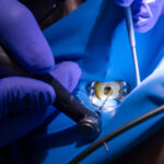 Antibiotici in endodonzia, un nuovo sistema di rilascio Antibiotici