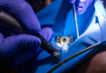 Antibiotici in endodonzia, un nuovo sistema di rilascio Antibiotici