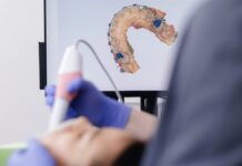 Impronta digitale: una nuova tecnica ne migliora la precisione Impronta digitale