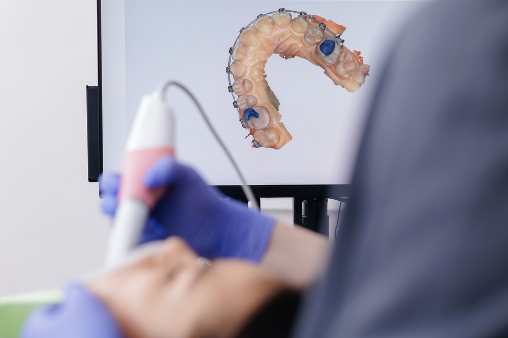 Dental,3d,Scan,Imaging,Process,With,Patient,With,Braces,And Impronta digitale