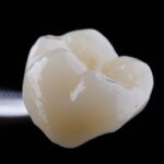 Zirconia, a 5 anni i restauri posteriori sopravvivono tutti Zirconia