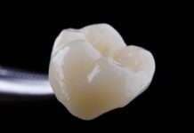 Zirconia, a 5 anni i restauri posteriori sopravvivono tutti Zirconia