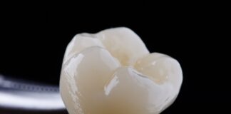 Zirconia, a 5 anni i restauri posteriori sopravvivono tutti Zirconia