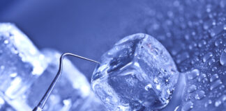 Crioterapia intracanalare, meno dolore dopo la terapia endodontica crioterapia endocanalare