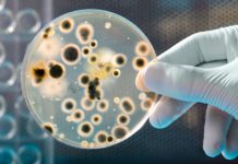 Infezioni associate all’assistenza domiciliare