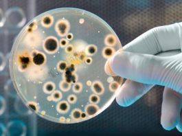 Infezioni associate all’assistenza domiciliare