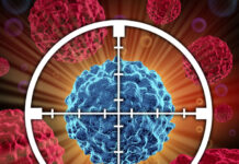 Medulloblastoma, scoperto l’enzima a monte