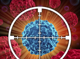 Medulloblastoma, scoperto l’enzima a monte