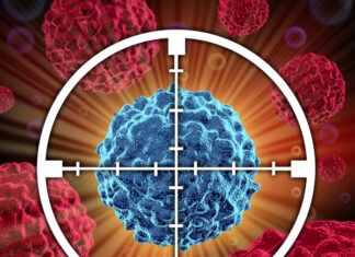 Medulloblastoma, scoperto l’enzima a monte