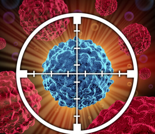 Medulloblastoma, scoperto l’enzima a monte