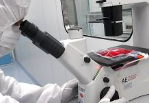 Leucemia mieloide acuta nei pazienti pediatrici, speranze da terapia con CAR-T