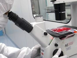 Leucemia mieloide acuta nei pazienti pediatrici, speranze da terapia con CAR-T