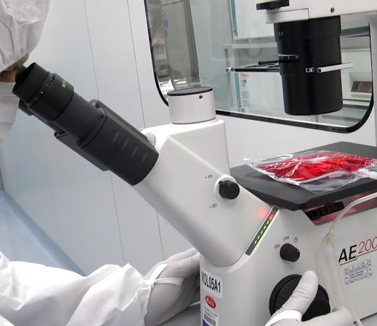 Leucemia mieloide acuta nei pazienti pediatrici, speranze da terapia con CAR-T