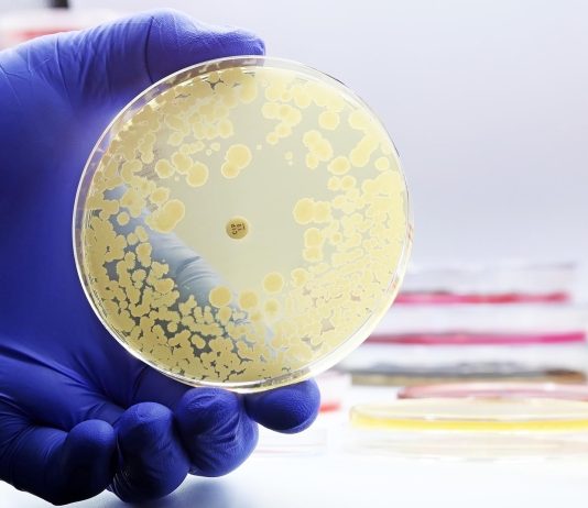 Resistenza antimicrobica nelle infezioni pediatriche