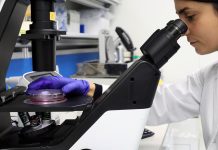 Mononucleosi e sclerosi multipla nei bambini: confermato il legame