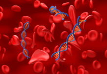 Terapia CRISPR, efficace anche nei bambini con beta-talassemia e anemia falciforme