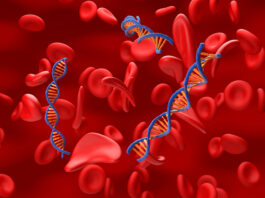 Terapia CRISPR, efficace anche nei bambini con beta-talassemia e anemia falciforme