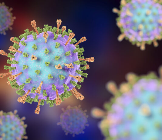 Parotite: epidemiologia e determinanti delle epidemie