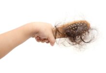 Alopecia grave pediatrica: in sperimentazione una terapia biologica