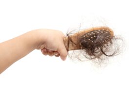 Alopecia grave pediatrica: in sperimentazione una terapia biologica