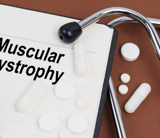Una nuova possibilità terapeutica per la sindrome di Duchenne