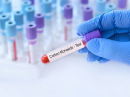 Intossicazione da monossido di carbonio