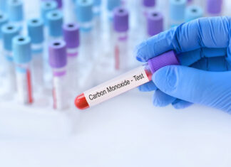 Intossicazione da monossido di carbonio