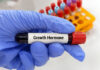Ormone della crescita a lunga durata d’azione e incremento della massa corporea