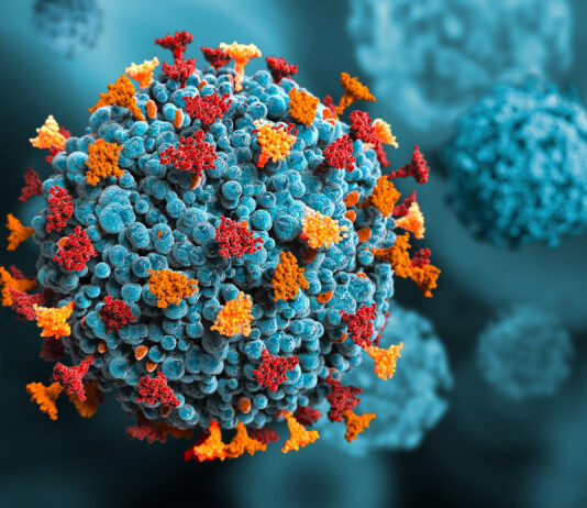 Infezione da Hantavirus