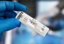 Test rapidi per l’antigene dello streptococco di gruppo A nei bambini con infezioni extrafaringee