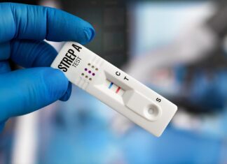 Test rapidi per l’antigene dello streptococco di gruppo A nei bambini con infezioni extrafaringee