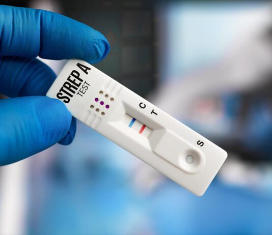 Test rapidi per l’antigene dello streptococco di gruppo A nei bambini con infezioni extrafaringee