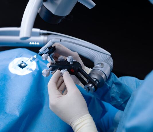 La robotica entra nella microchirurgia cocleare pediatrica