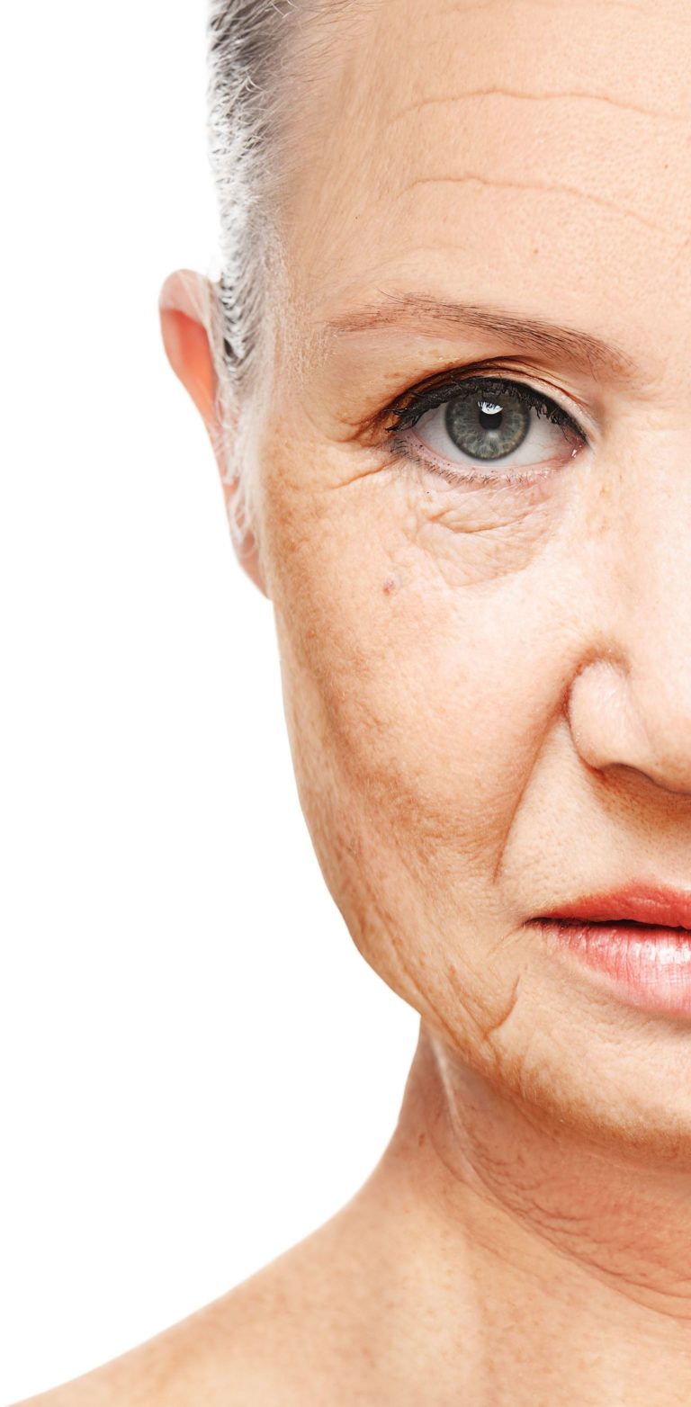 Trattamento spot-lightening