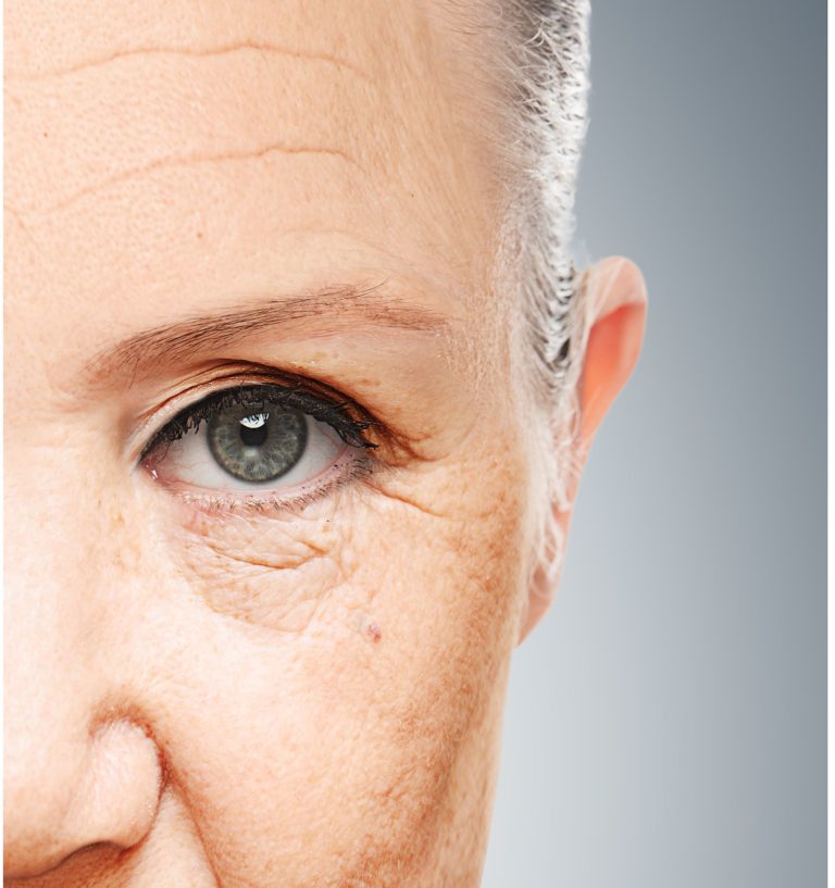 Impatto dell’inquinamento urbano sulla pelle: uno studio multicentrico in Messico