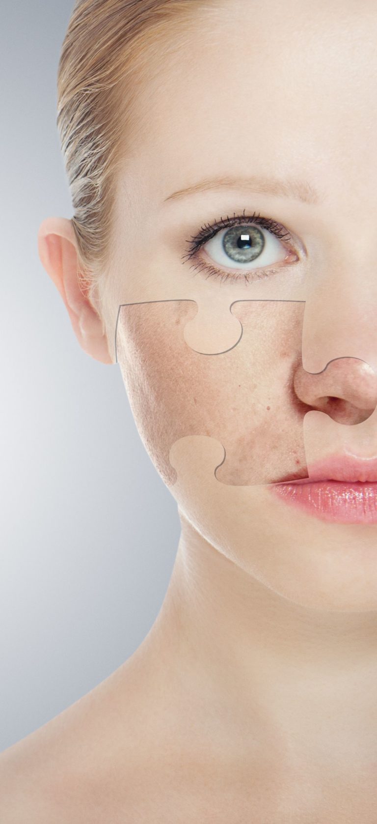 Alfa-idrossiacidi applicati sulla pelle e su pori comedogeni