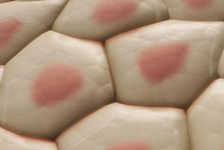 Allergeni da contatto