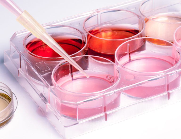 «Dispersal Rate» una caratteristica per prevedere l’affidabilità dell’SPF in vitro