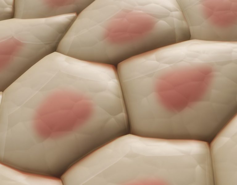 Ingredienti cosmetici responsabili dell’orticaria