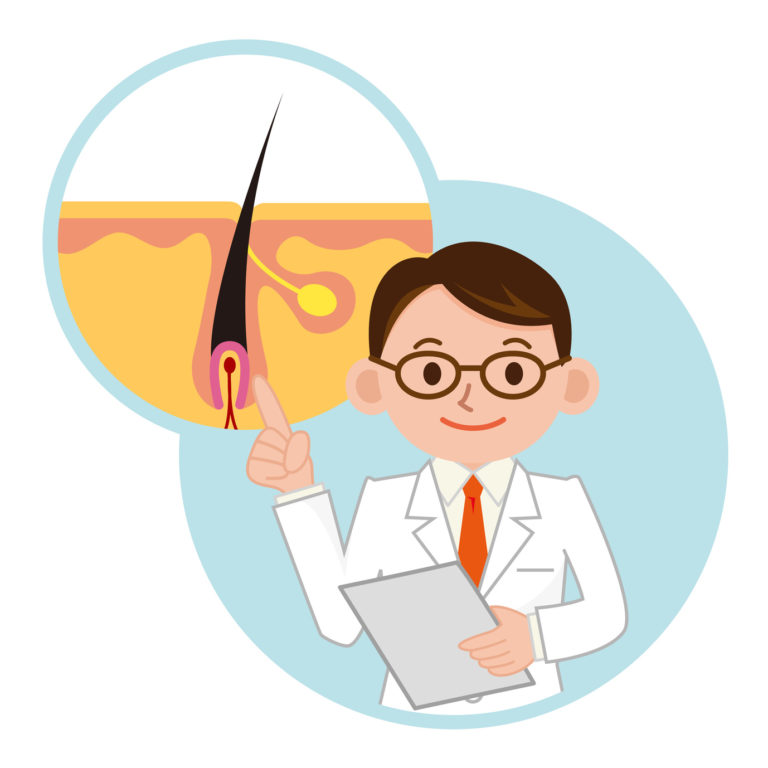 Il perché dei capelli «fini» nelle donne caucasiche